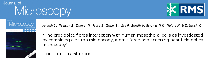 The crocidolite fibres interaction with human mesothelial cells as investigated by combining electron microscopy, atomic force and scanning near-field optical microscopy